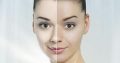 To get the smooth skin use Rollyhampy skin care products