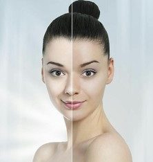 Get the clear glowing skin with Rollyhampy +27797455644