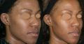Rollyhampy skin lightening/ bleaching cream, pills and soaps