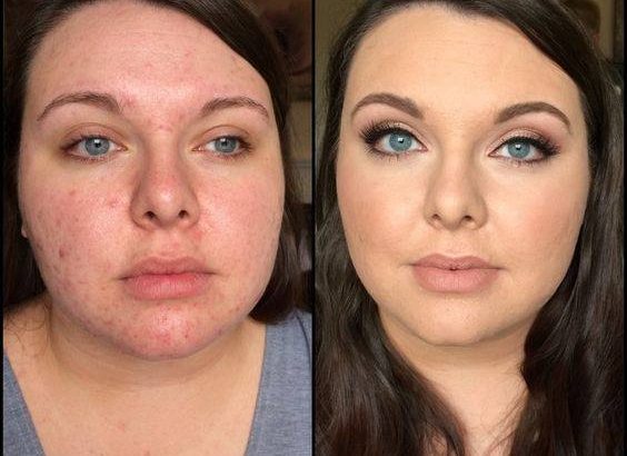 Get the clear glowing skin with Rollyhampy product +27760829927