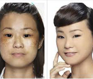 Best skin products for Rollyhampy Whitening and Lightening cream,soap, pills +27760829927