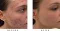 Best skin products for Rollyhampy Whitening and Lightening cream,soap, pills +27760829927