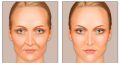 Rollyhampy has the most safe skin lightening products cream, soap& pills+27760829927