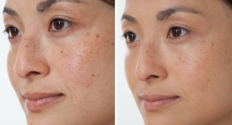 Rollyhampy anti aging solution +27797455644