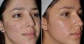 Rollyhampy skin lightening craems, pills and soaps 0797455644