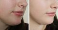 The most effective skin bleaching creams by Rollyhampy