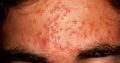 Get the healthy skin glow with Rollyhampy skin care products