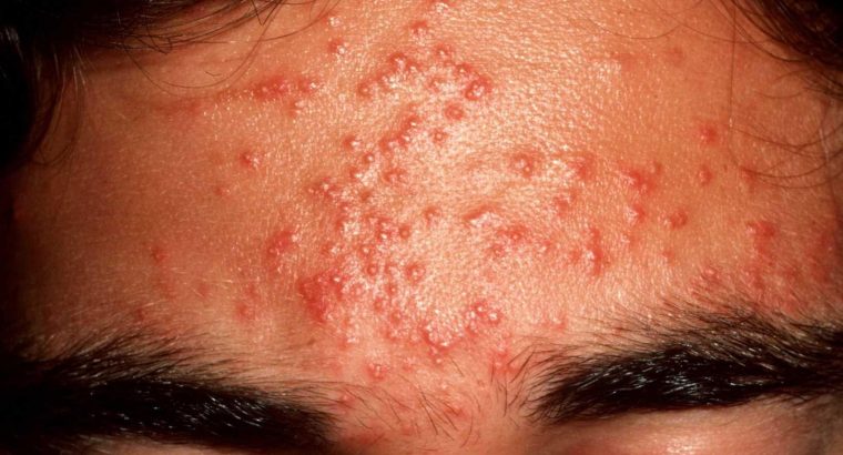 Get the healthy skin glow with Rollyhampy skin care products