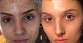Make your skin visibly bright with Rollyhampy skin care