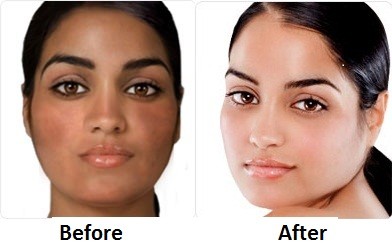 Get the smooth and soft skin with Rollyhampy skin care products