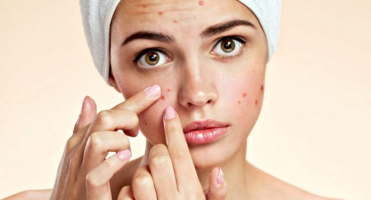 Skin lightening creams from Rollyhampy +27797455644