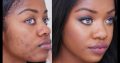 Get the healthy skin glow with Rollyhampy skin care products
