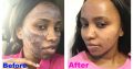 Skin lightening creams from Rollyhampy +27797455644