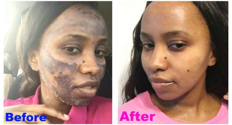 Skin lightening creams from Rollyhampy +27797455644