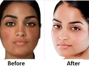 Rollyhampy skin bleaching products +27760829927