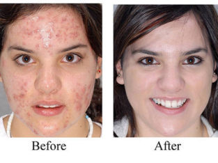 If you want to achieve the amazing results use