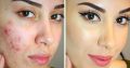 Rollyhampy skin lightening/ bleaching products +27