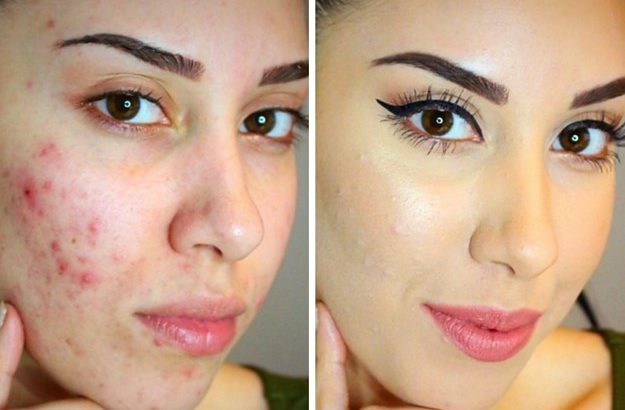 Rollyhampy skin lightening/ bleaching products +27