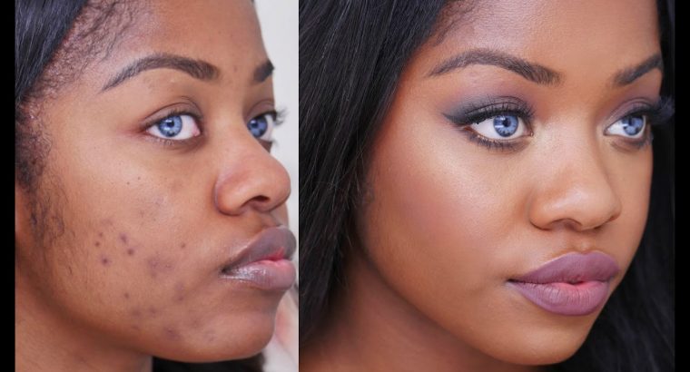 Get the healthy and glowing skin with Rollyhampy 0