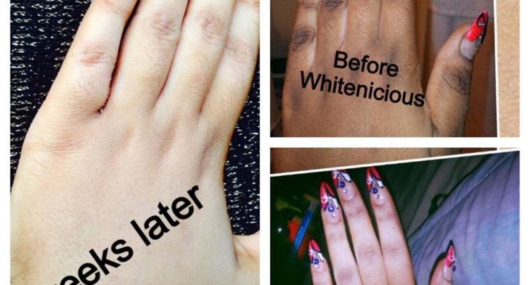 Perfect Skin Lightening Creams for Dark Skin,