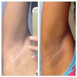 Perfect Skin Lightening Creams for Dark Skin,