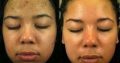 Lightens & Removes Mask of Pregnancy +27784024696