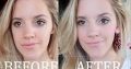 Lightens & Removes Mask of Pregnancy +27784024696