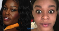 Remove age spots and acne scars with Rollyahmpy
