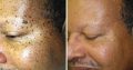 uality skin products Glutathione creams and Ivory