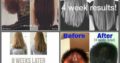 Intensive Hair & Scalp System