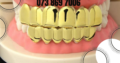 Teeth Grillz CLIP ON Teeth Grills