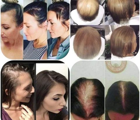 Intensive Hair & Scalp System
