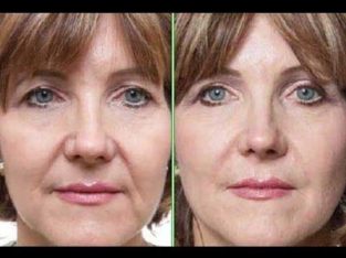 Face lift in a bottle