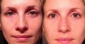 Face lift in a bottle