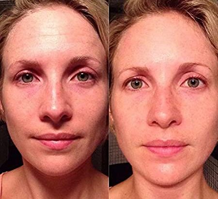 Face lift in a bottle