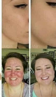 Tinted Moisturizer
