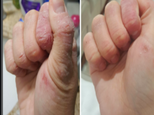 Hand Lotion