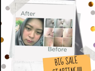 20% DISCOUNT