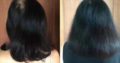 Intensive Hair & Scalp System