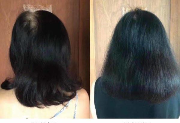 Intensive Hair & Scalp System