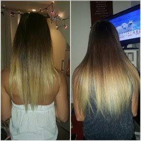 Intensive Hair & Scalp System