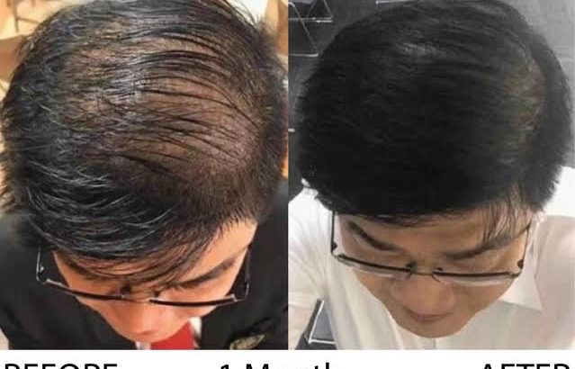 Intensive Hair & Scalp System