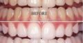 AP24 whitening toothpaste