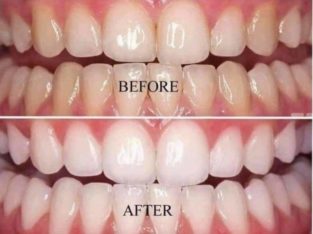 AP24 whitening toothpaste