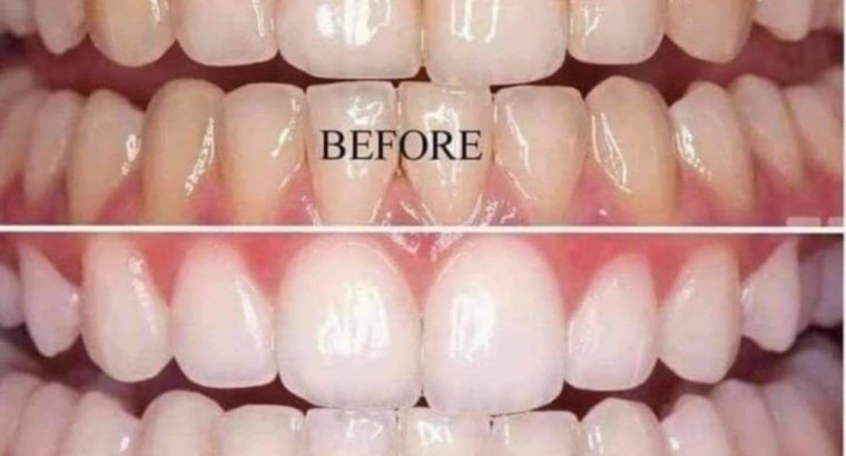 AP24 whitening toothpaste