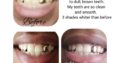 AP24 whitening toothpaste