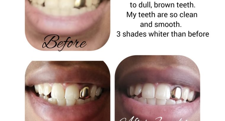 AP24 whitening toothpaste