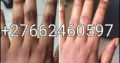 Skin and body care