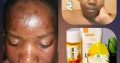 Umgalelo Skincare Products