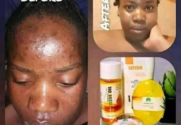 Umgalelo Skincare Products